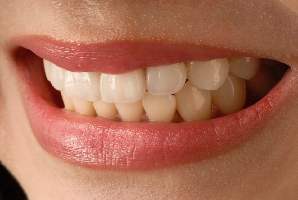 Veneers on a Funds: Exploring Insurance coverage Protection Choices for Smile Makeovers