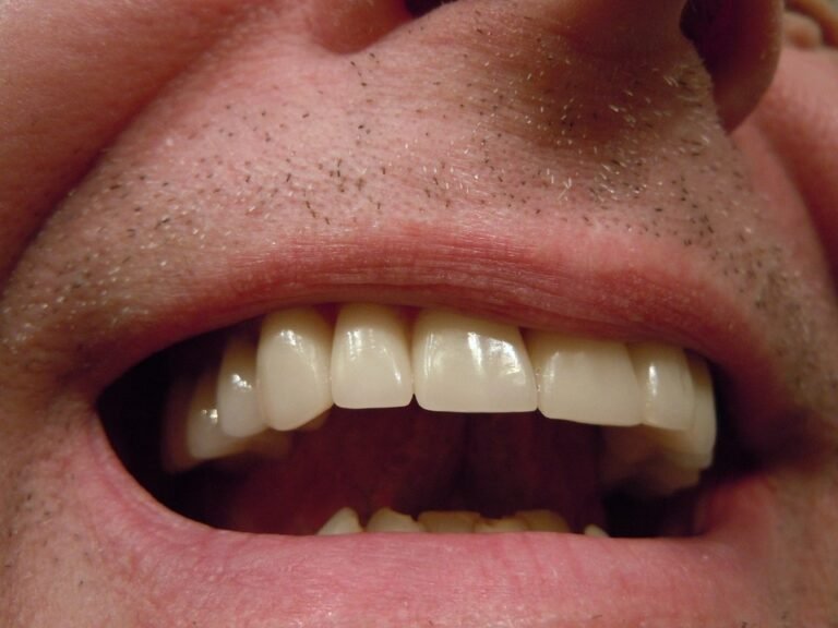 Tooth Fact: When Will Insurance coverage Cowl Veneers?